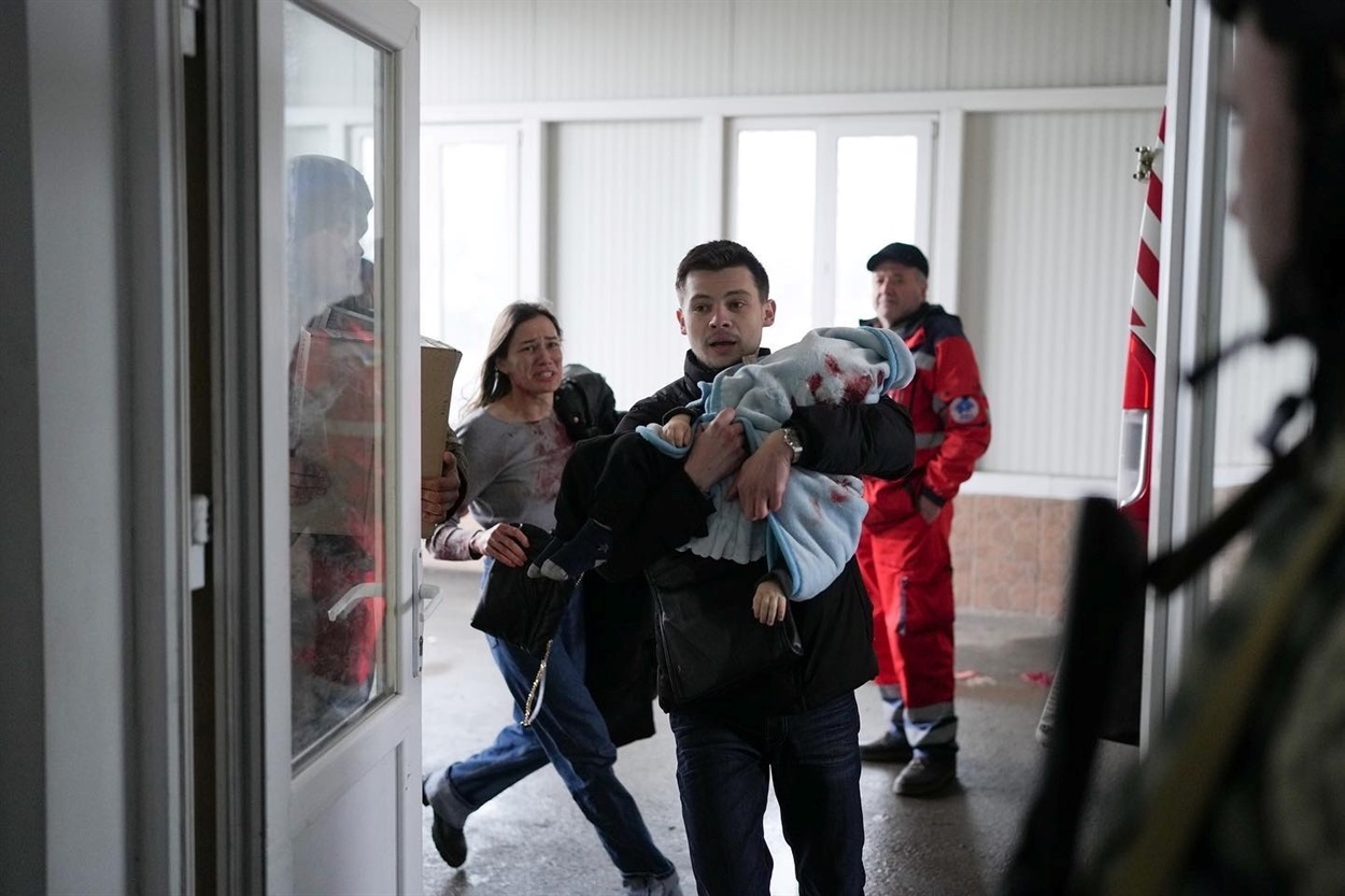 A child killed during the shelling. Photo by Yevhen Malolyetka